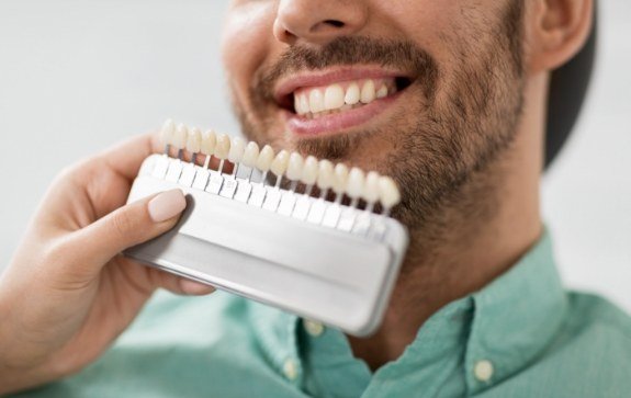 Patient's smile compared to porcelain veneer shade charts