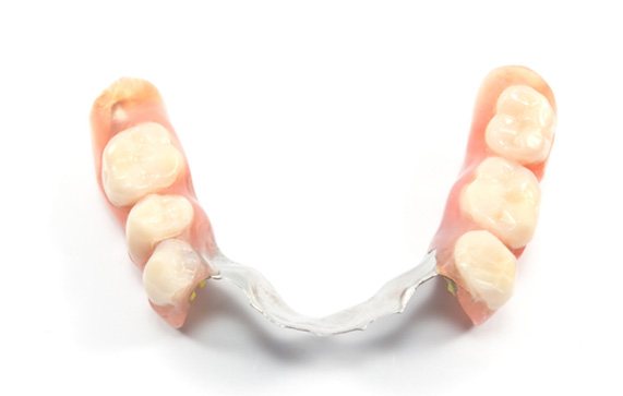 A closeup of a partial denture