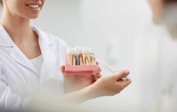 Dental team member explaining the cost of dental implants