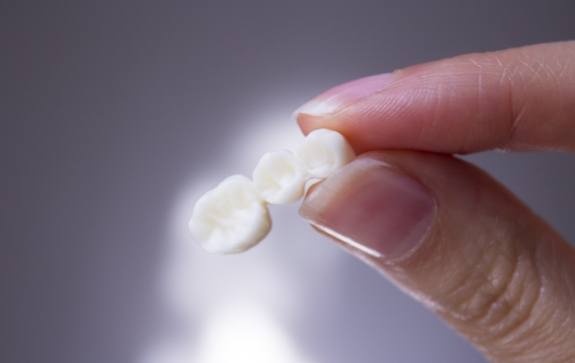 Hand holding a dental bridge prior to placement