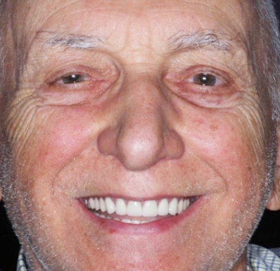 Older man with full healthy smile