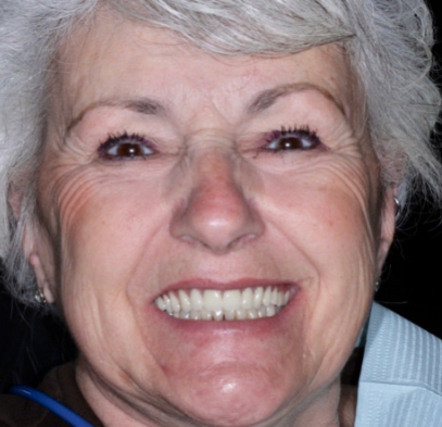 Older woman with healthy complete smile
