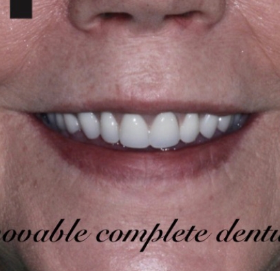 Closeup of brilliant smile after cosmetic dentistry