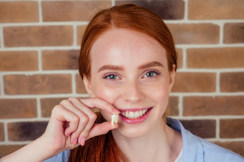 Woman smiling after toth extraction