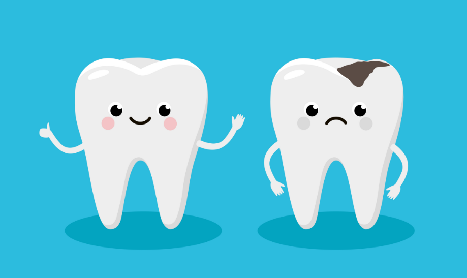 Cartoon of two teeth; one healthy, one with cavity