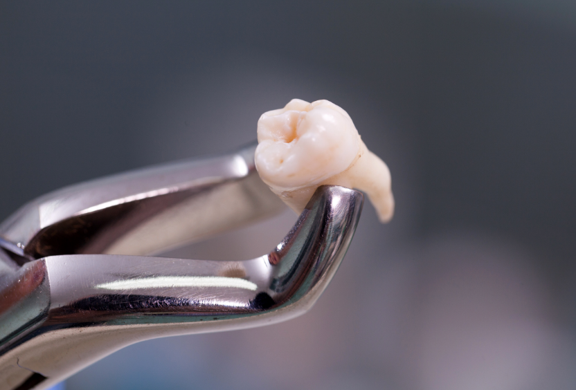 Close up of tooth